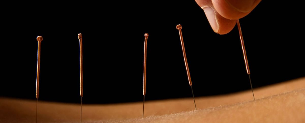 Acupuncture treatment Banner Image