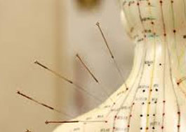 ACUPUNCTURE