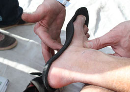 CUSTOM ORTHOTICS